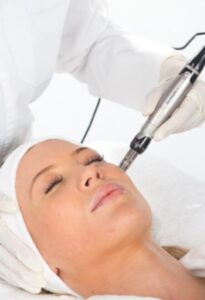 Skin Needling Melbourne